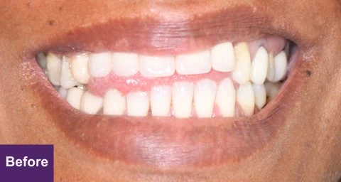 Before Clinical Case 2
